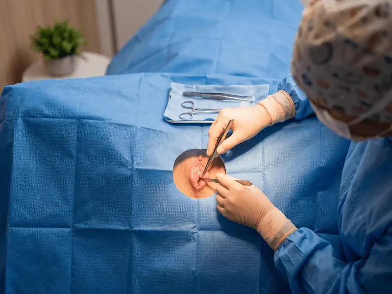 Intróito vaginal interno: correção cirúrgica com foco funcional